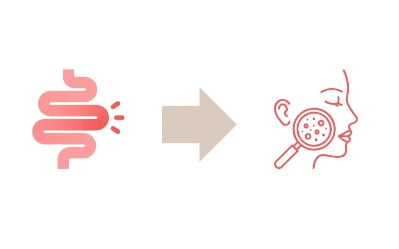 microbiote intestinal et santé de la peau