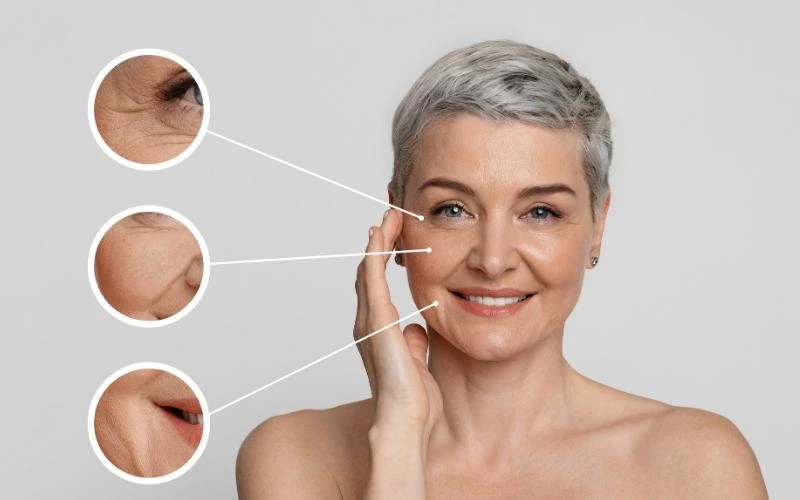 zoom sur les zone du visage marquées par le temps