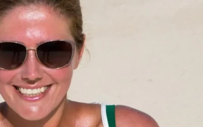 Comment réparer sa peau après l’été