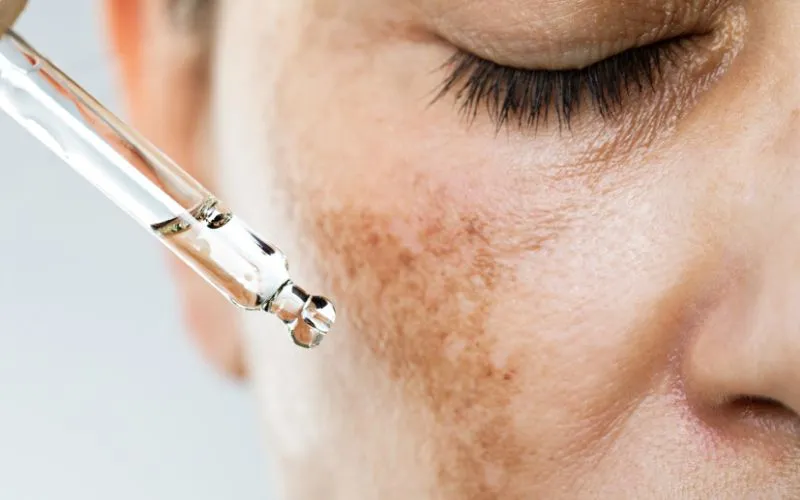 femme qui nourrit sa peau avec une huile